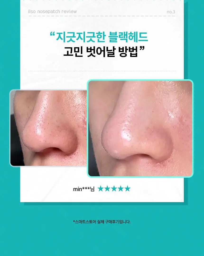 [1등코팩/5관왕] 일소 네추럴 마일드 클리어 노우즈 팩 5매입 상세페이지 7
